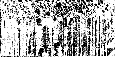 Рис. 5. Биколатеральный сосудистый пучок из стебля тыквы (поперечный и продольный разрез).